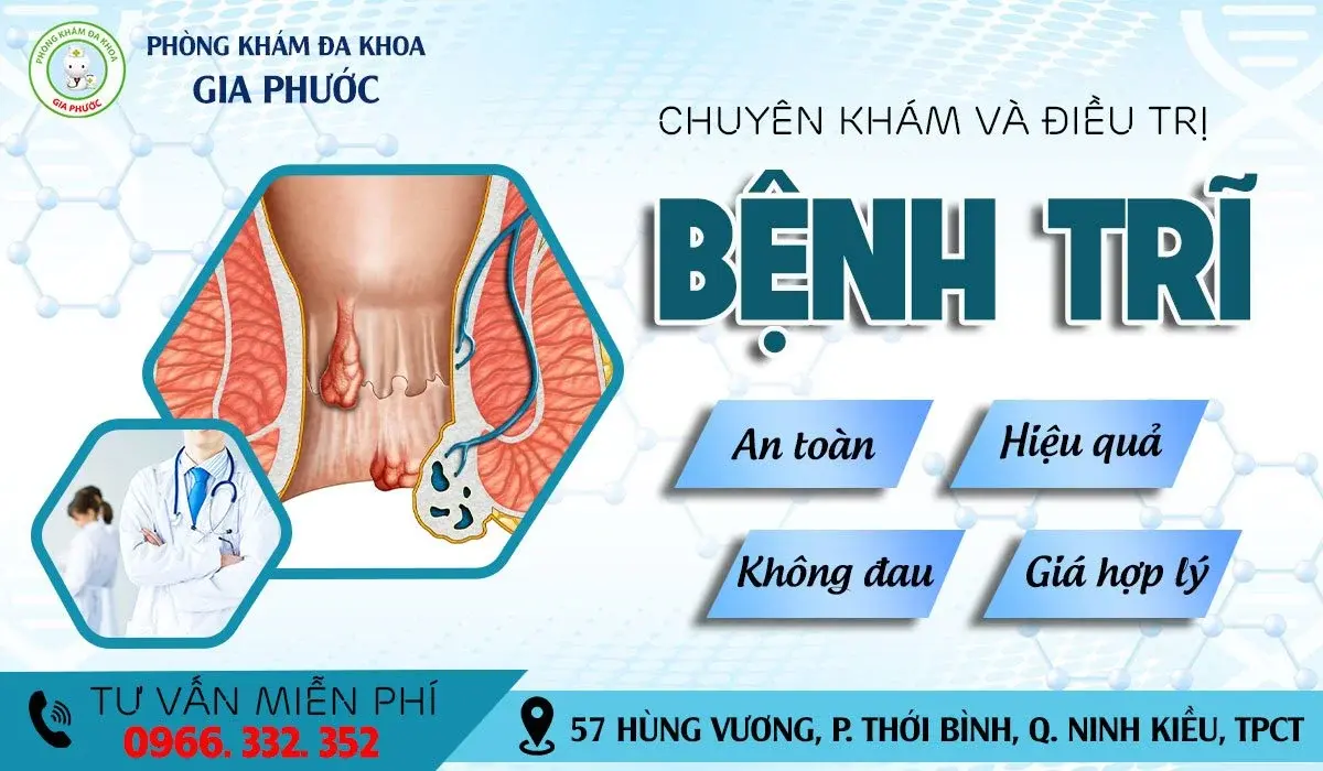 Địa Chỉ Chữa Bệnh Trĩ Ngoại