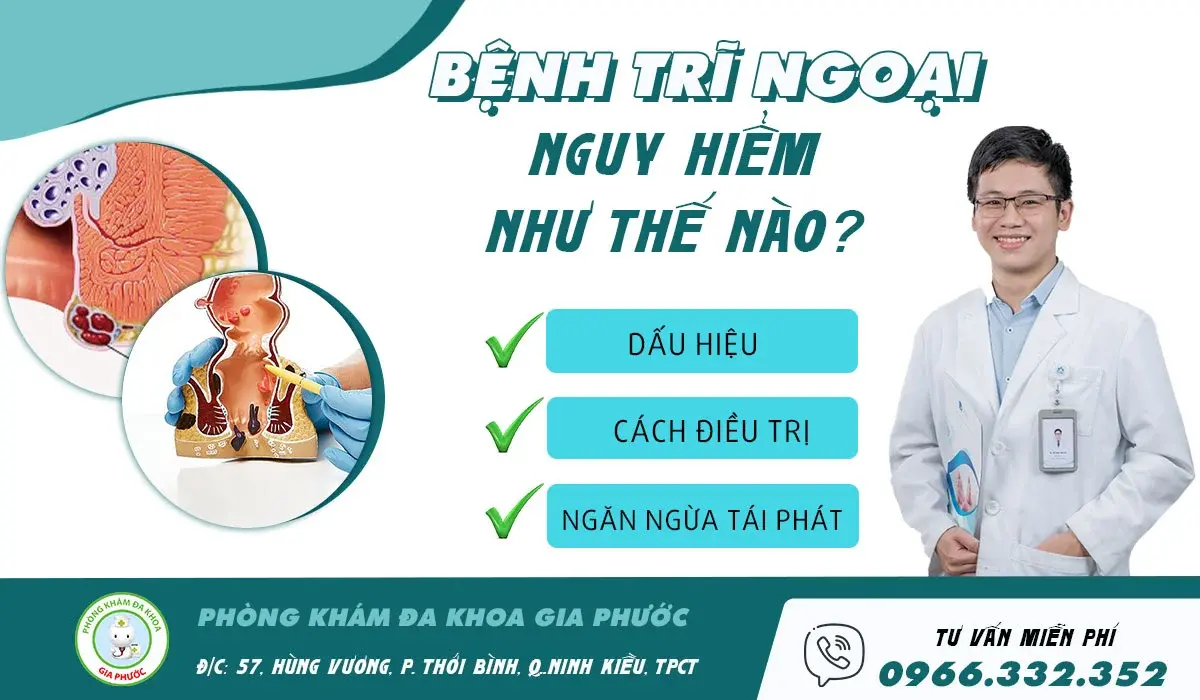 Phương Pháp Chữa Trị Bệnh Trĩ Ngoại An Toàn
