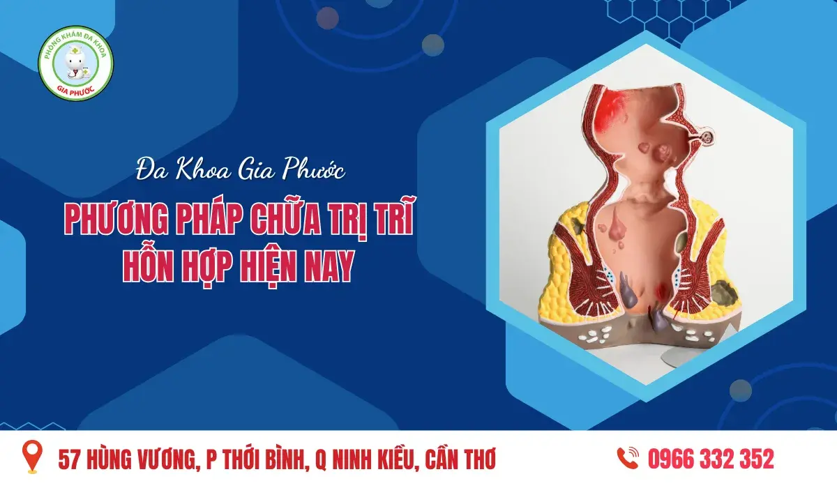 Các Phương Pháp Chữa Trị Trĩ Hỗn Hợp Hiện Nay