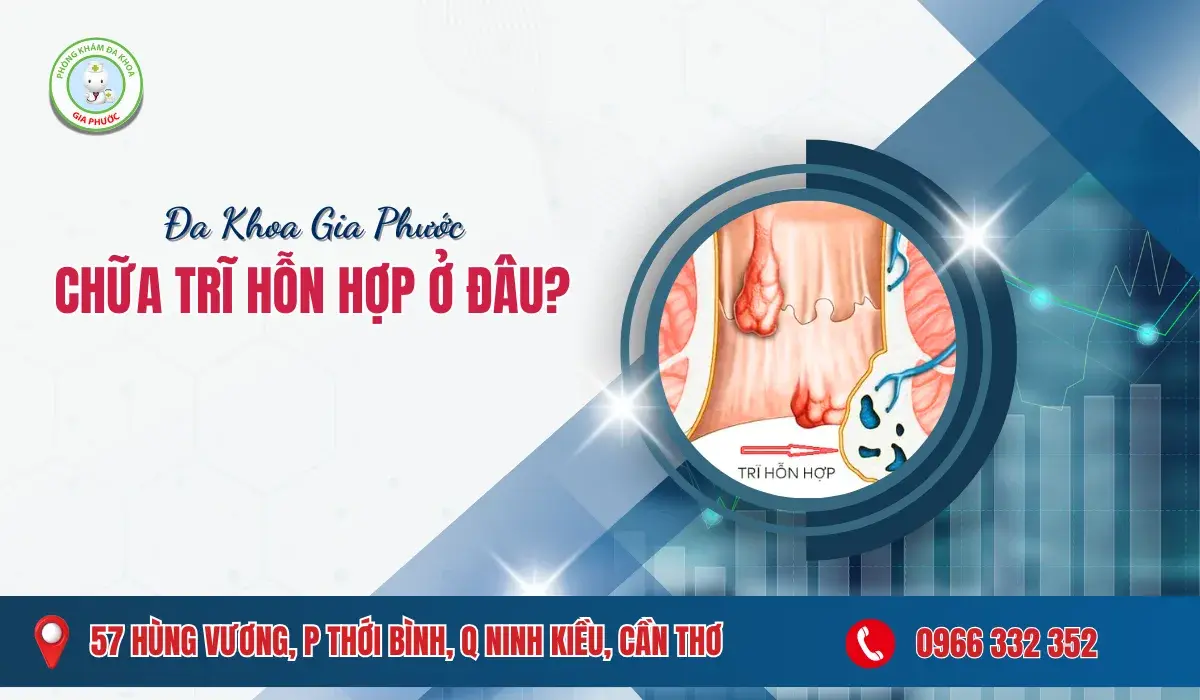 Chữa Trĩ Hỗn Hợp Ở Đâu?