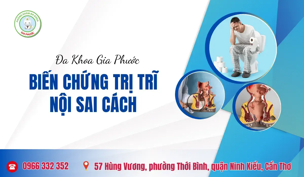 Biến Chứng Khi Chữa Trĩ Nội Sai Cách