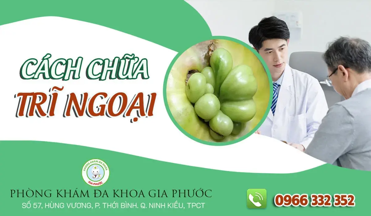Cách chữa bệnh trĩ ngoại an toàn, hiệu quả