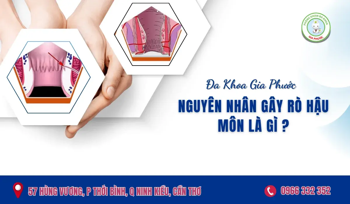 Nguyên Nhân Gây Rò Hậu Môn Là Gì?