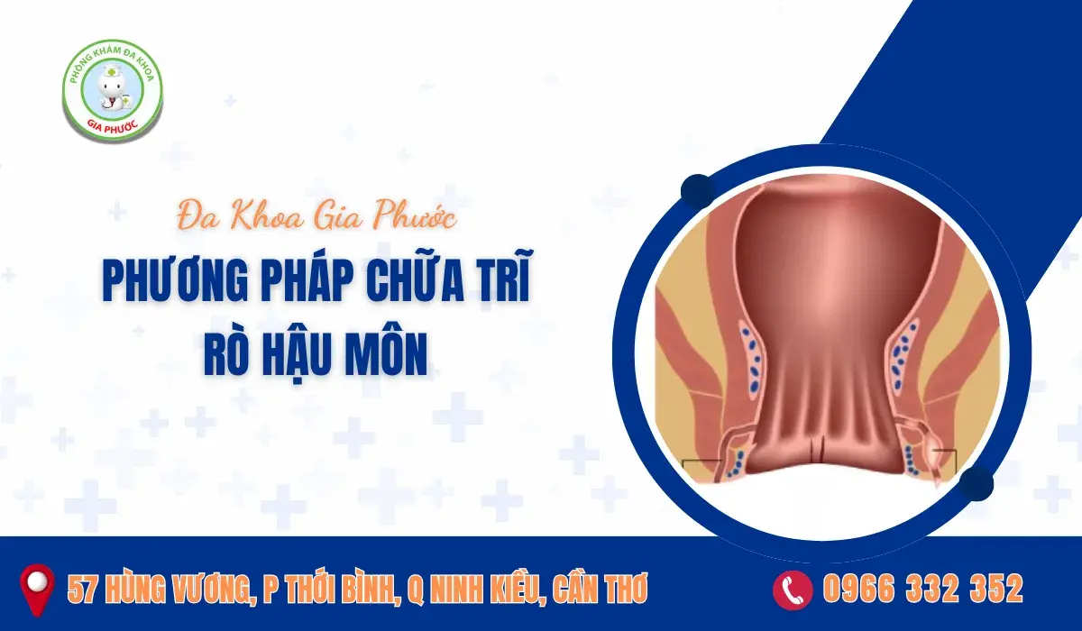 Phương Pháp Chữa Trĩ Rò Hậu Môn