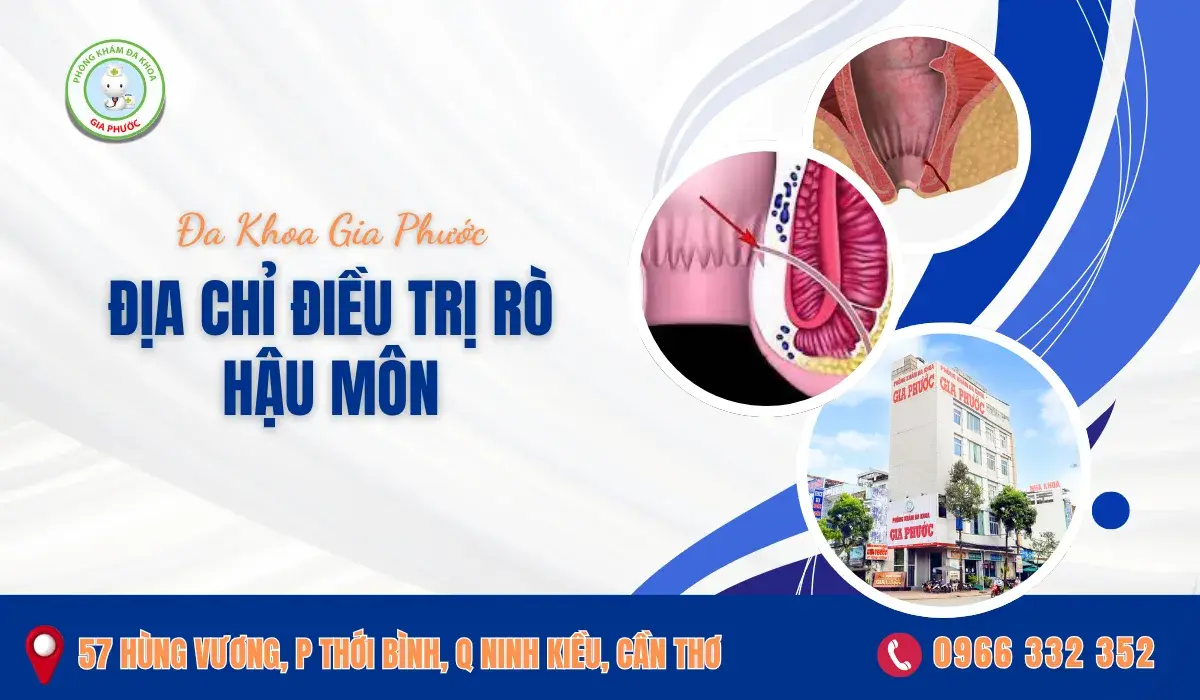 Địa Chỉ Chữa Trị Rò Hậu Môn