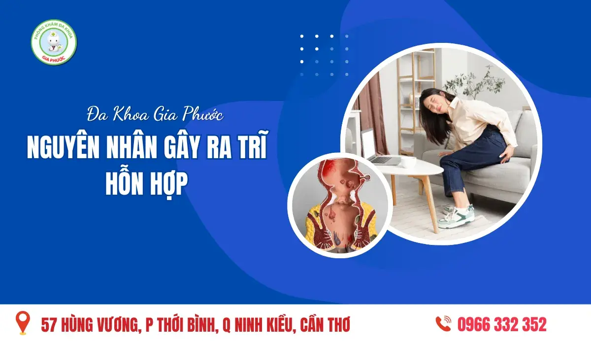 Nguyên Nhân Gây Ra Trĩ Hỗn Hợp